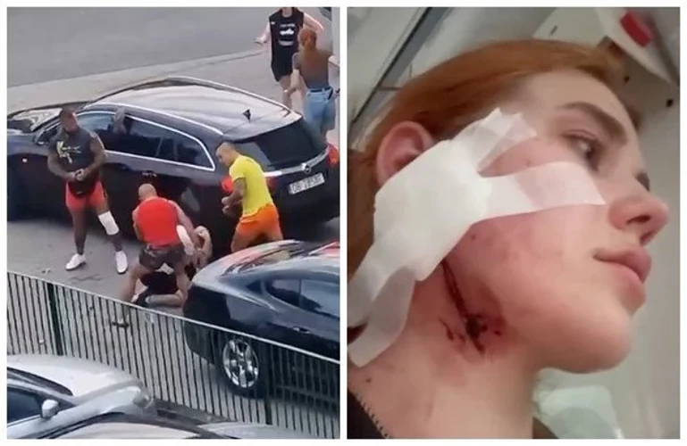 У Польщі біля магазину побили українську пару: дівчина отримала тяжкі травми шиї